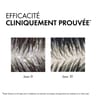 Vichy dercos anti pelliculaire shampooing normalisant gras 390ml